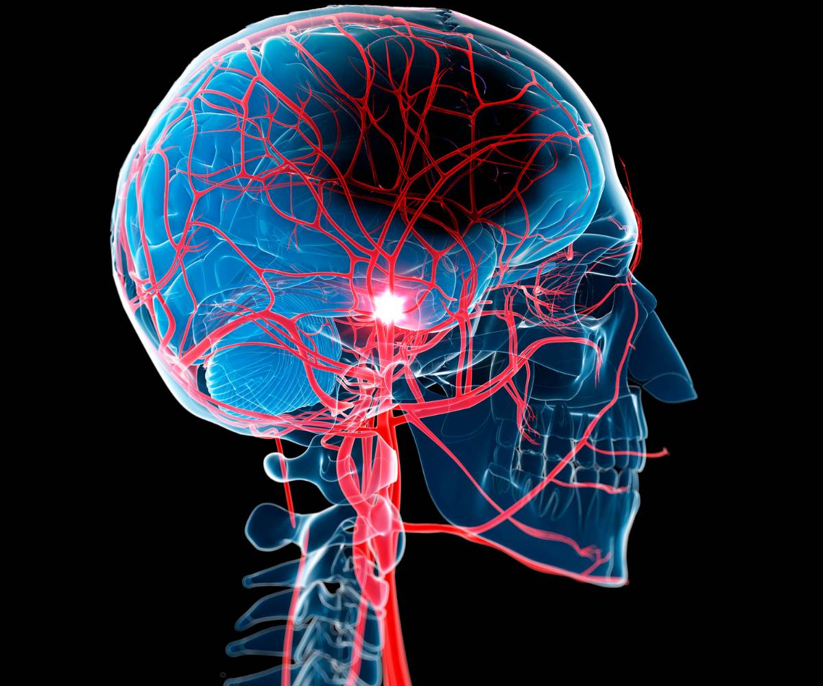 udar czy wylew. Zdjęcie przedstawia przekrój czaszki z widocznymi nerwami