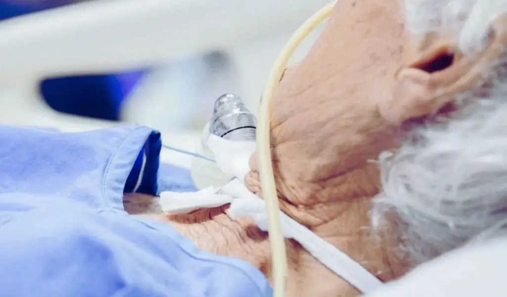 Zdjęcie przedstawia starszą osobę z rurką tracheostomijną, leżącą w łóżku. Widać oznaki choroby, zależność od aparatury i potrzebę stałej opieki. W takich sytuacjach ogromne znaczenie ma dodatek do energii elektrycznej z PFRON, który pomaga pokryć koszty działania sprzętu medycznego w domu.